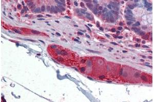 Human Small Intestine, submucosal plexus: Formalin-Fixed, Paraffin-Embedded (FFPE) (TUBB2A 抗体  (AA 1-446))