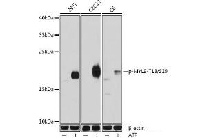 Western blot analysis of extracts of various cell lines using Phospho-MYL9(T18/S19) Polyclonal Antibody at dilution of 1:1000. (MYL9 抗体  (pSer19, pThr18))
