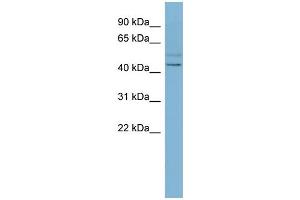 Western Blotting (WB) image for anti-Solute Carrier Family 46 (Folate Transporter), Member 1 (SLC46A1) (N-Term) antibody (ABIN2781711)