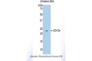 Western blot analysis of the recombinant protein. (PLAT 抗体  (AA 359-532))