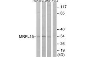 Western blot analysis of extracts from HeLa/HuvEc/MCF-7 cells, using MRPL15 Antibody. (MRPL15 抗体  (AA 191-240))