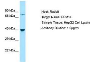 Image no. 1 for anti-Protein Phosphatase, Mg2+/Mn2+ Dependent, 1L (PPM1L) (AA 141-190) antibody (ABIN6750224) (PPM1L 抗体  (AA 141-190))