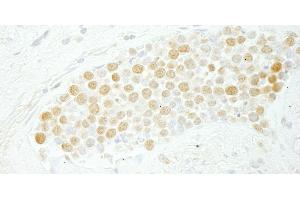 Immunohistochemistry (IHC) image for anti-CDC5 Cell Division Cycle 5-Like (S. Pombe) (CDC5L) (AA 752-802) antibody (ABIN7448468)