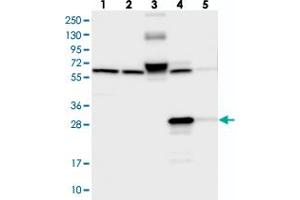 Western blot analysis of Lane 1: RT-4, Lane 2: U-251 MG, Lane 3: Human Plasma, Lane 4: Liver, Lane 5: Tonsil with ECHDC3 polyclonal antibody  at 1:250-1:500 dilution. (ECHDC3 抗体)