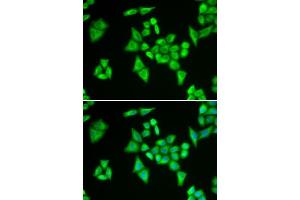 Immunofluorescence analysis of HeLa cells using ADSL antibody. (Adenylosuccinate Lyase 抗体  (AA 1-310))