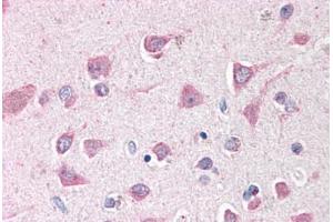 Human Brain, Cortex (formalin-fixed, paraffin-embedded) stained with ING3 antibody ABIN291938 at 2. (ING3 抗体  (AA 294-304))