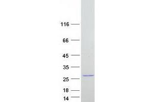 Western Blotting (WB) image for Bcl2 Modifying Factor (BMF) (Transcript Variant 2) protein (Myc-DYKDDDDK Tag) (ABIN2715285)