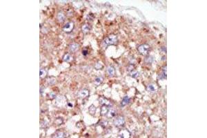 Image no. 2 for anti-PTK6 Protein tyrosine Kinase 6 (PTK6) (N-Term) antibody (ABIN359990) (PTK6 抗体  (N-Term))
