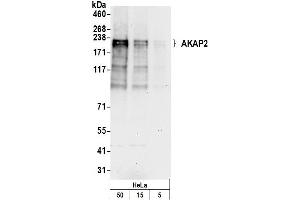 Western Blotting (WB) image for anti-A Kinase (PRKA) Anchor Protein 2 (AKAP2) (AA 75-125) antibody (ABIN7449867)