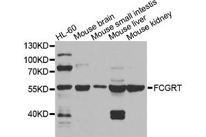 Western blot analysis of extracts of various cell lines, using FCGRT antibody. (FcRn 抗体)