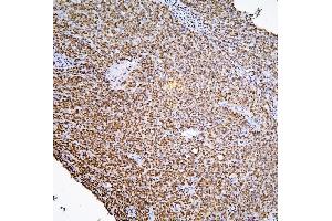 IHC analysis of PHF21A using anti-PHF21A antibody (ABIN6719353). (PHF21A 抗体  (AA 1-97))