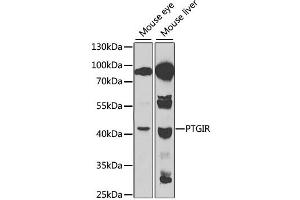 Western blot analysis of extracts of various cell lines, using PTGIR antibody. (Prostacyclin Receptor 抗体)