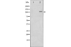 Western blot analysis of NF- kappaB p100/p52 phosphorylation expression in ovary cancer whole cell lysates,The lane on the left is treated with the antigen-specific peptide. (NFKB2 抗体  (pSer866))