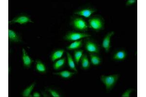 Immunofluorescence staining of A549 cells with ABIN7147387 at 1:100, counter-stained with DAPI. (CEP135 抗体  (AA 94-195))