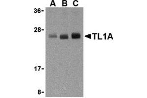 Western Blotting (WB) image for anti-Tumor Necrosis Factor (Ligand) Superfamily, Member 15 (TNFSF15) (N-Term) antibody (ABIN1031618) (TNFSF15 抗体  (N-Term))