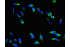 Immunofluorescent analysis of Hela cells using ABIN7147742 at dilution of 1:100 and Alexa Fluor 488-congugated AffiniPure Goat Anti-Rabbit IgG(H+L) (Chymotrypsin 抗体  (AA 90-220))