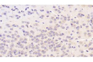 Immunohistochemistry (IHC) image for anti-Vav 1 Oncogene (VAV1) (AA 565-795) antibody (ABIN7444313)