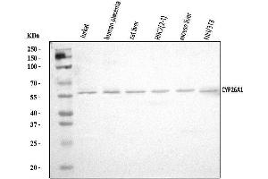 Western blot analysis of CYP26A1 using anti-CYP26A1 antibody (ABIN7602874).