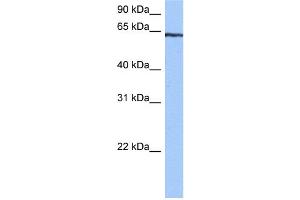 WB Suggested Anti-TTC6 Antibody Titration:  0. (TTC6 抗体  (C-Term))