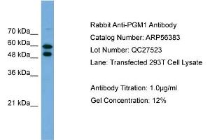 Western Blotting (WB) image for anti-Phosphoglucomutase 1 (PGM1) (Middle Region) antibody (ABIN785805) (Phosphoglucomutase 1 抗体  (Middle Region))