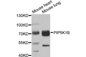 Western blot analysis of extracts of various cell lines, using PIP5K1B antibody. (PIP5K1B 抗体)