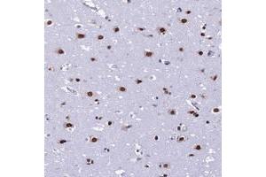 Immunohistochemical staining of human cerebral cortex with PRAMEF12 polyclonal antibody  shows strong nuclear positivity in neuronal cells. (PRAMEF12 抗体)