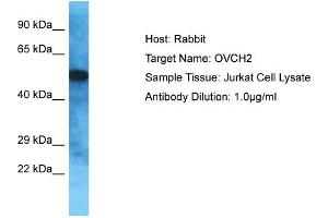 Host: Rabbit Target Name: OVCH2 Sample Type: Jurkat Whole Cell lysates Antibody Dilution: 1. (OVCH2 抗体  (C-Term))