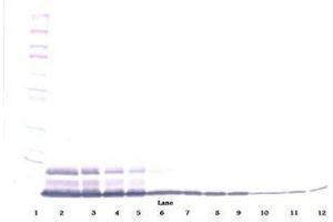 Image no. 2 for anti-Interleukin 8 (IL8) antibody (ABIN465358) (IL-8 抗体)