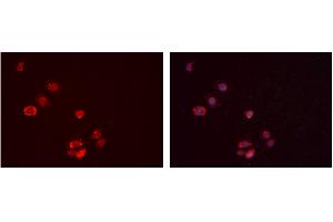 ABIN6277388 staining Hela cells by IF/ICC. (IGFBP7 抗体  (Internal Region))