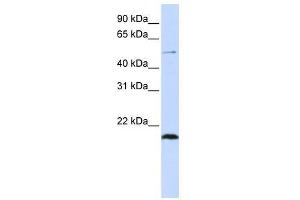 Western Blot showing ZNF683 antibody used at a concentration of 1-2 ug/ml to detect its target protein. (ZNF683 抗体  (N-Term))