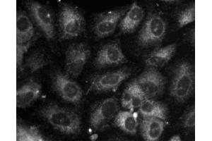 Immunofluorescent staining of A549 (ATCC CCL-185) cells. (Calnexin 抗体  (AA 116-301))