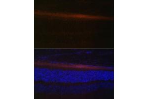Immunofluorescence analysis of rat retina using RDH5 Polyclonal Antibody (ABIN6130851, ABIN6146839, ABIN6146840 and ABIN6224076) at dilution of 1:100 (40x lens). (RDH5 抗体  (AA 24-318))