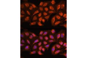Immunofluorescence (IF) image for anti-Mitochondrial Ribosomal Protein L45 (MRPL45) (AA 57-306) antibody (ABIN6144020)