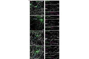 Staining Methods (StM) image for anti-Microtubule-Associated Protein 2 (MAP2) antibody (ABIN361345)