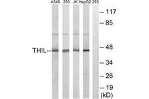 Western blot analysis of extracts from HepG2/Jurkat/293/A549 cells, using ACAT1 Antibody. (ACAT1 抗体  (AA 221-270))
