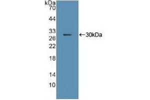 Detection of Recombinant Ki67P, Human using Polyclonal Antibody to Ki-67 Protein (Ki-67) (Ki-67 抗体  (AA 3088-3235))