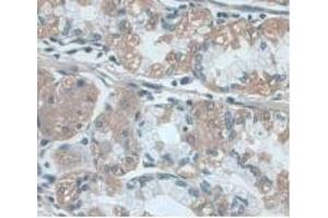 Detection of UCP2 in Human Stomach Tissue using Monoclonal Antibody to Mitochondrial Uncoupling Protein 2 (UCP2) (UCP2 抗体  (AA 154-289))