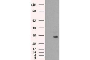 HEK293T cells were transfected with the pCMV6-ENTRY control (Left lane) or pCMV6-ENTRY FAHD2A (Right lane) cDNA for 48 hrs and lysed. (FAHD2A 抗体)