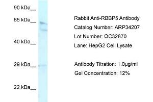 WB Suggested Anti-RBBP5 Antibody Titration:  0. (RBBP5 抗体  (Middle Region))
