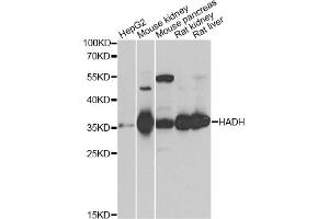 Western blot analysis of extracts of various cell lines, using HADH antibody. (HADH 抗体)