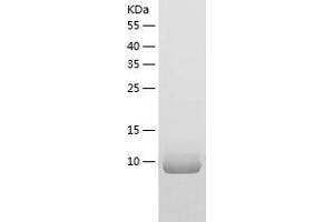 Western Blotting (WB) image for Fibronectin Type III Domain Containing 5 (FNDC5) (AA 15-127) protein (His tag) (ABIN7122963) (FNDC5 Protein (AA 15-127) (His tag))