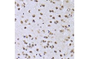 Immunohistochemistry of paraffin-embedded mouse brain using EFTUD2 Antibody (ABIN5974236) at dilution of 1/100 (40x lens). (EFTUD2 抗体)