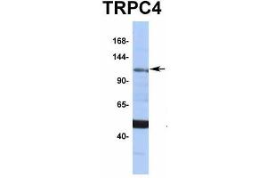 Western Blotting (WB) image for anti-Transient Receptor Potential Cation Channel, Subfamily C, Member 4 (TRPC4) (Middle Region) antibody (ABIN2776213)