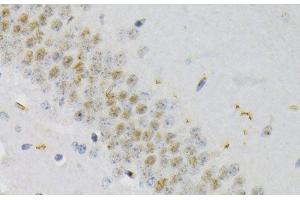 Immunohistochemistry of paraffin-embedded Mouse brain using Phospho-CREB1(S133) Polyclonal Antibody at dilution of 1:200 (40x lens). (CREB1 抗体  (pSer133))