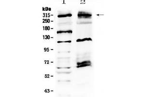 Western blot analysis of MED13 using anti-MED13 antibody . (MED13 抗体  (AA 61-240))