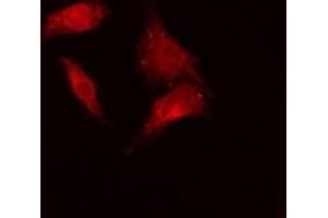 ABIN6279204 staining Hela cells by IF/ICC.