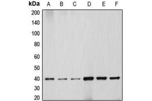 Western blot analysis of HSP40 expression in HEK293T (A), HeLa (B), NIH3T3 (C), PC12 (D), Jurkat (E), HepG2 (F) whole cell lysates. (DNAJB1 抗体  (C-Term))