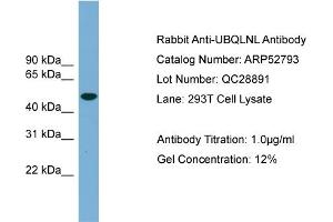 WB Suggested Anti-UBQLNL  Antibody Titration: 0. (UBQLNL 抗体  (Middle Region))