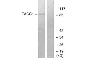 Western Blotting (WB) image for anti-Transforming, Acidic Coiled-Coil Containing Protein 1 (TACC1) (N-Term) antibody (ABIN1849024) (TACC1 抗体  (N-Term))