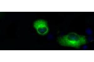 Image no. 3 for anti-Amyloid beta (A4) Precursor Protein (APP) antibody (ABIN1496878) (APP 抗体)